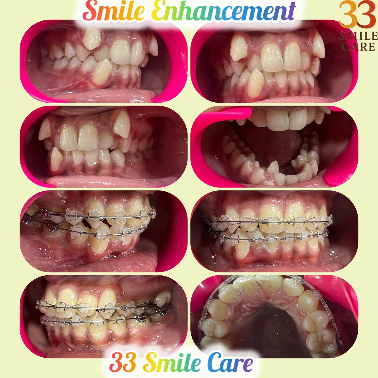 WhatsApp Image 2025-11-22 at 01.00.49