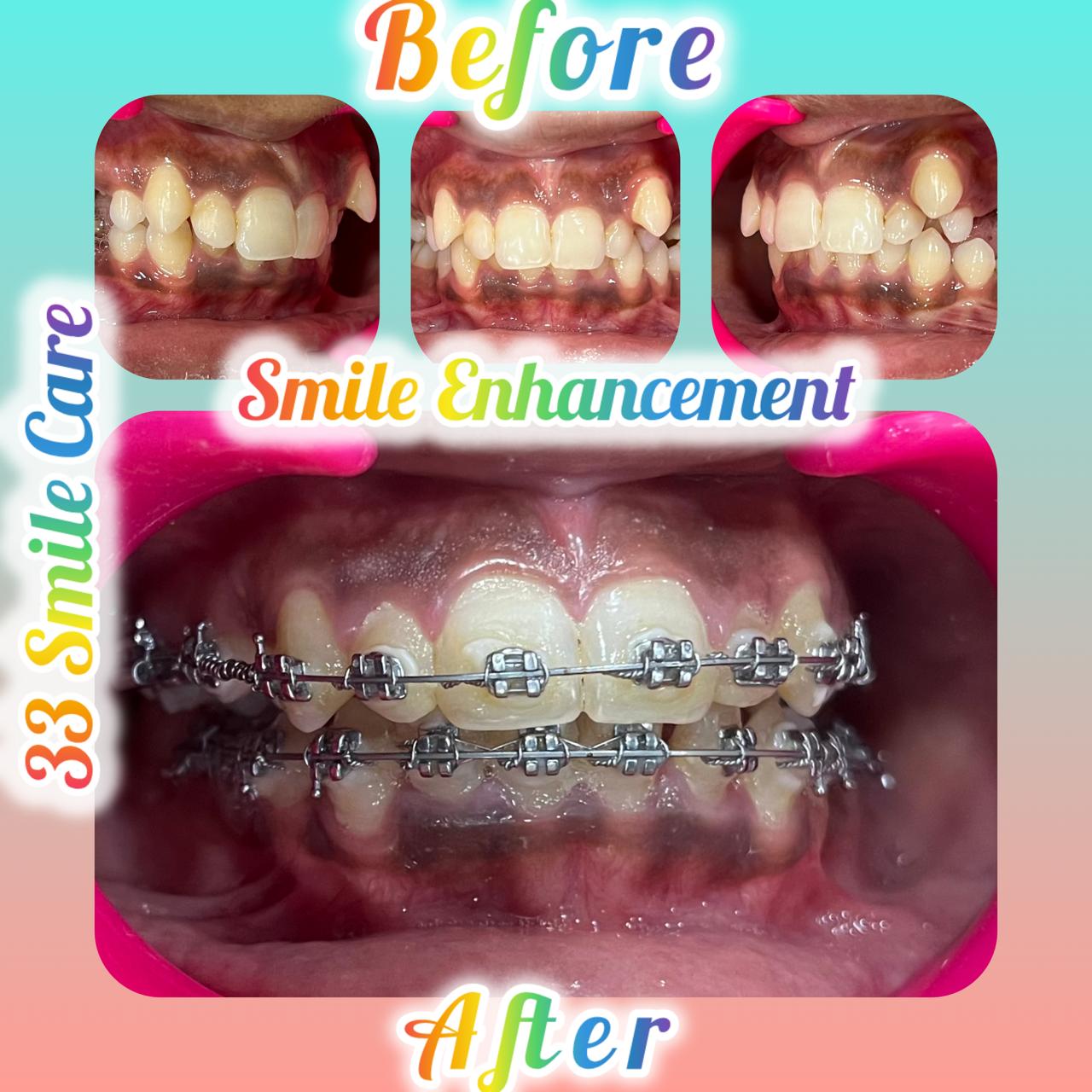 WhatsApp Image 2025-11-22 at 01.13.37