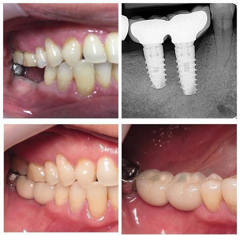 WhatsApp Image 2025-12-16 at 00.14.03