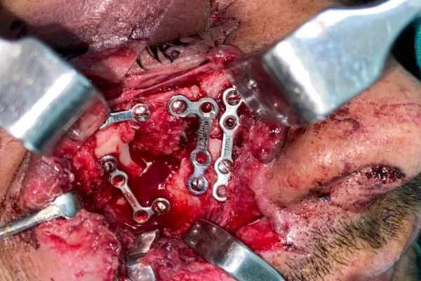 WhatsApp Image 2025-11-22 at 01.48.20 (1)