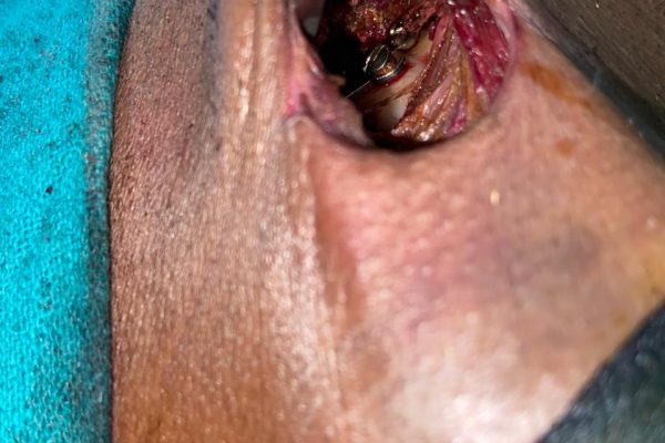 WhatsApp Image 2025-11-22 at 01.48.21